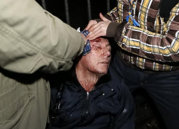 Sumuštas buvęs vidaus reikalų ministras J. Lucenka paguldytas į reanimacijos palatą