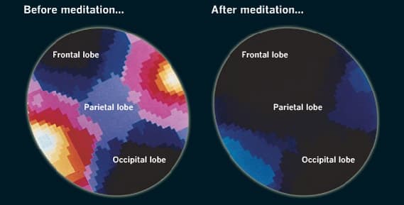 Smegenys prieš (kairėje) ir po meditacijos
