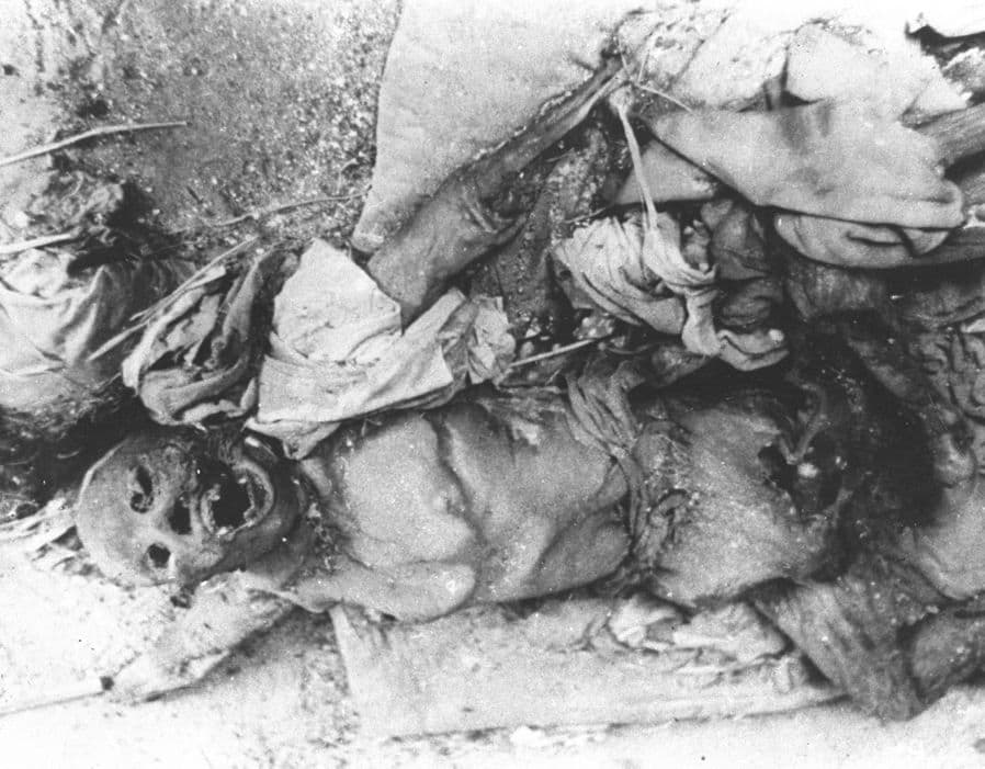 Viena iš tūkstančių JAV atominių bombų aukų Japonijoje.