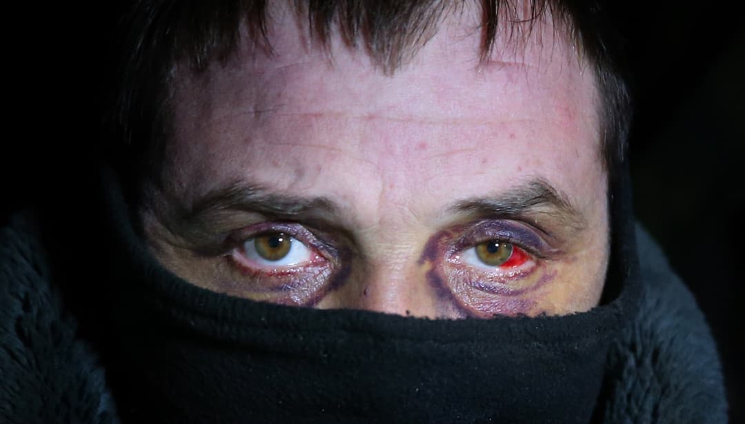 Ukraina pasirengusi mainyti vieną belaisvį į tris kovotojus